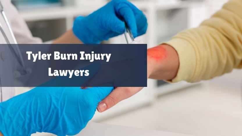 Tyler Burn Injury Lawyers