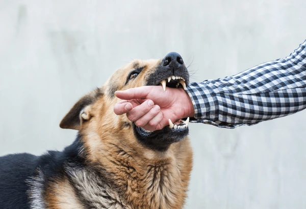 Texas Dog Bite Injury Attorney